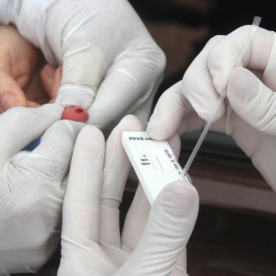 Unidades Básicas de Saúde de Taubaté passam a realizar testes de Covid mediante agendamento