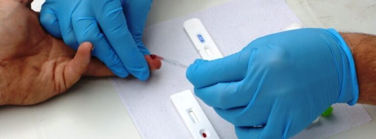 Caraguatatuba realiza teste rápido para para HIVSífilis neste sábado (3)